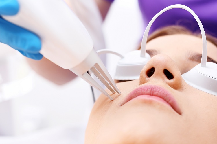 Trị sẹo bằng Laser Fractional CO2