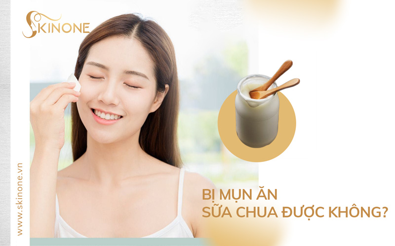 Bị mụn ăn sữa chua được không? Giải đáp chi tiết