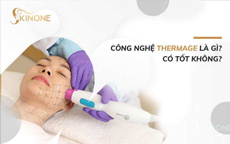 Công nghệ Thermage là gì? Có tốt không?