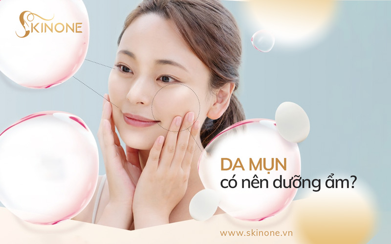 Da mụn có nên dưỡng ẩm không? Phương pháp dưỡng ẩm tốt nhất