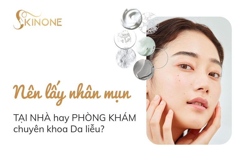 Nên lấy nhân mụn tại nhà hay phòng khám chuyên khoa Da liễu?