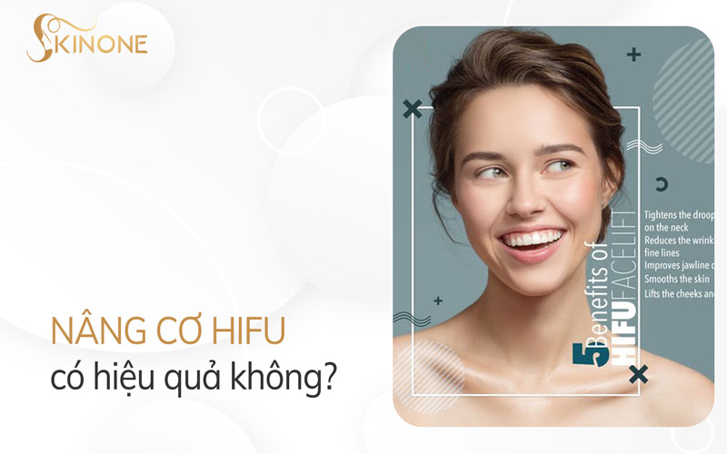 Nâng cơ Hifu có hiệu quả không?