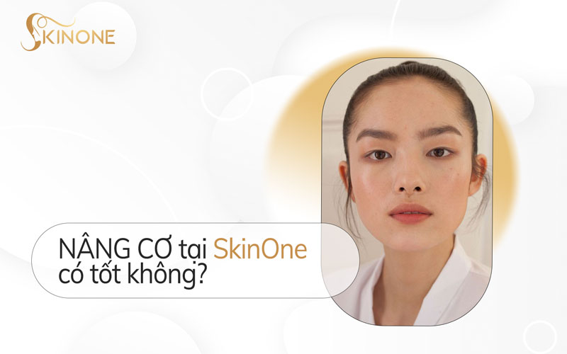 Nâng cơ tại Skinone có tốt không?