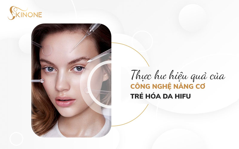 Thực hư hiệu quả của công nghệ nâng cơ trẻ hóa da Hifu