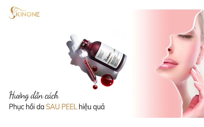 Hướng dẫn cách phục hồi da sau Peel hiệu quả