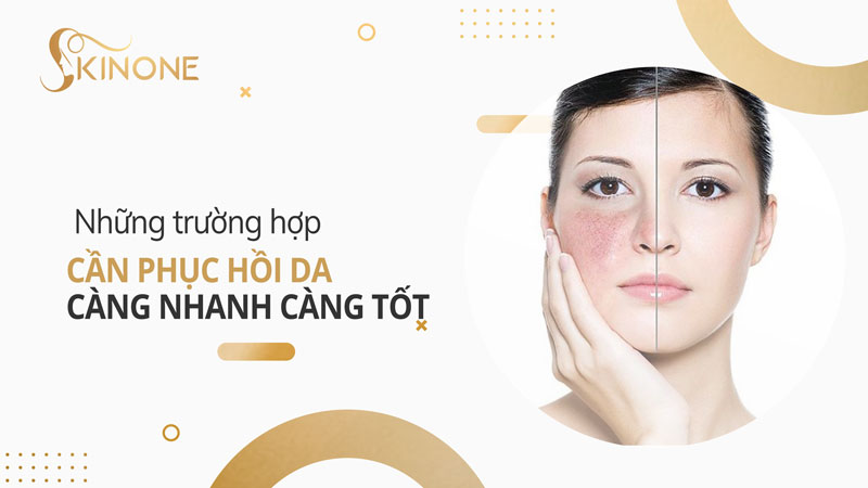 Những trường hợp cần phục hồi da càng nhanh càng tốt