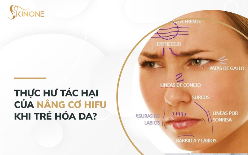 Thực hư tác hại của nâng cơ Hifu khi trẻ hóa da?