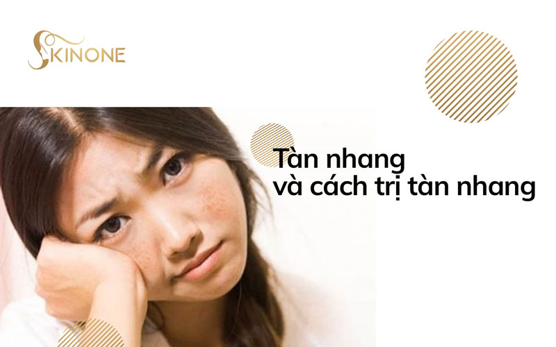 Tàn nhang là gì và cách trị tàn nhang