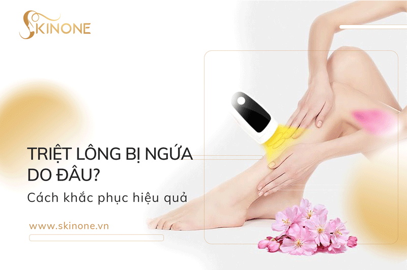 Triệt lông bị ngứa do đâu? Cách khắc phục hiệu quả