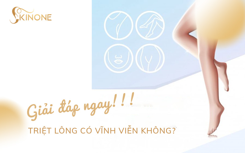 Triệt lông có vĩnh viễn không? Giải đáp NGAY