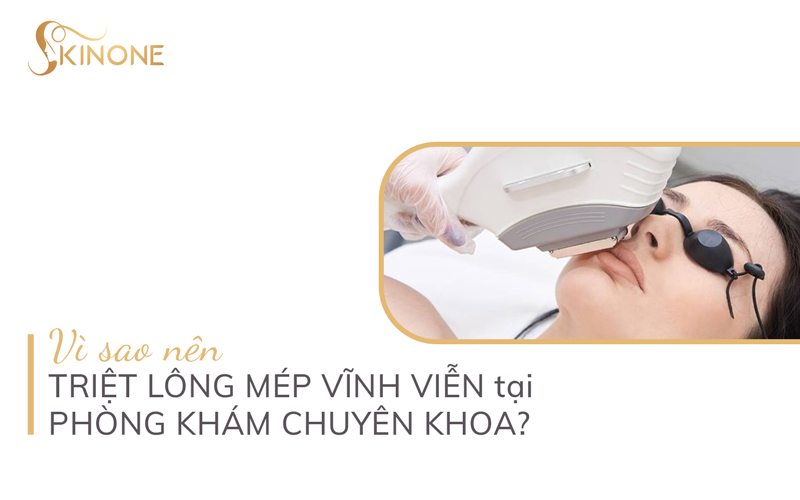 Vì sao nên triệt lông mép vĩnh viễn tại phòng khám chuyên khoa?