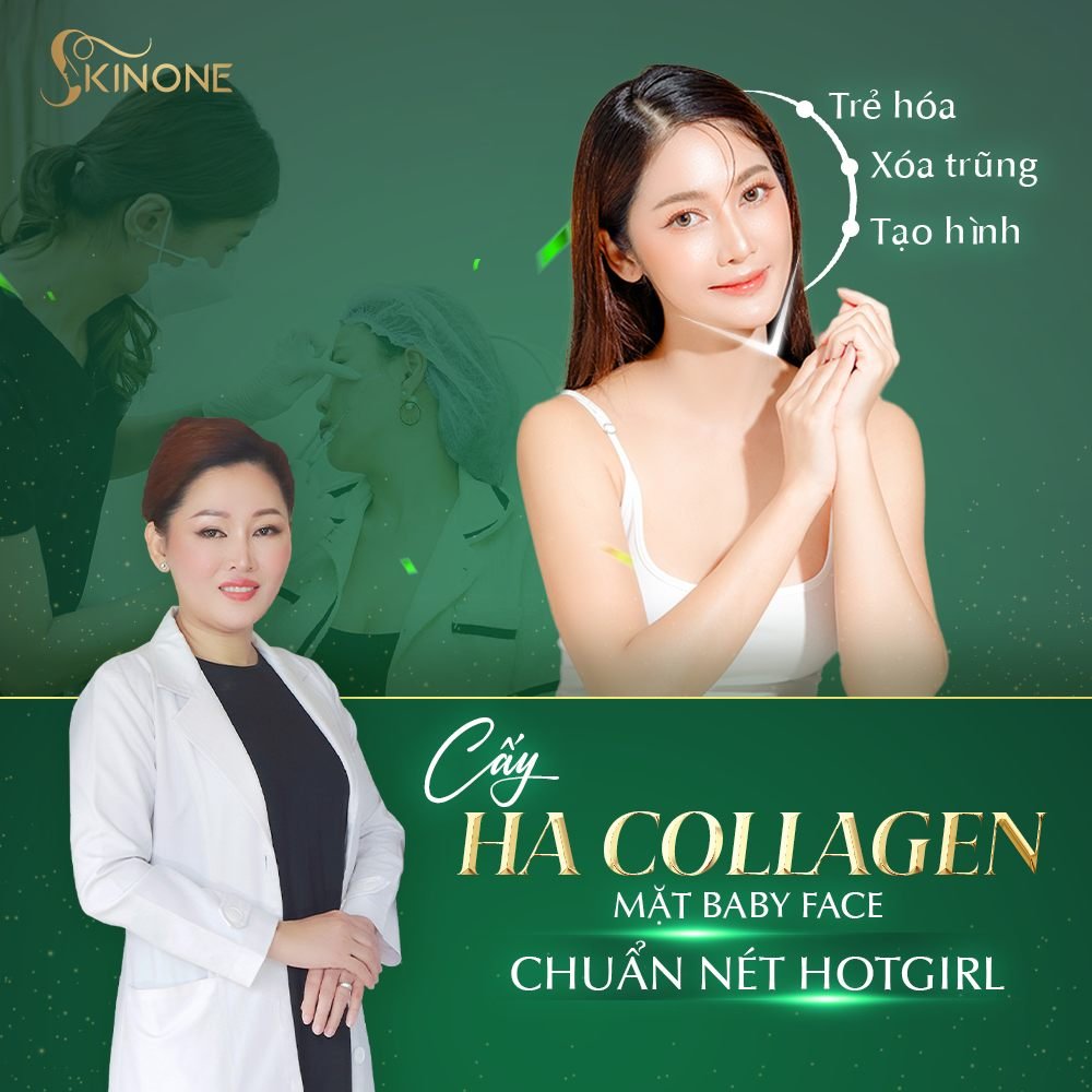 Cấy HA Collagen vùng má chỉ an toàn khi thực hiện 